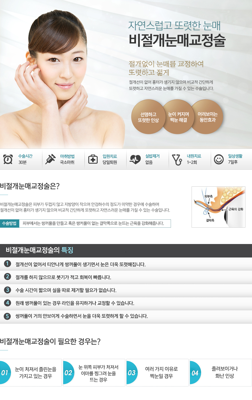 눈성형-비절개